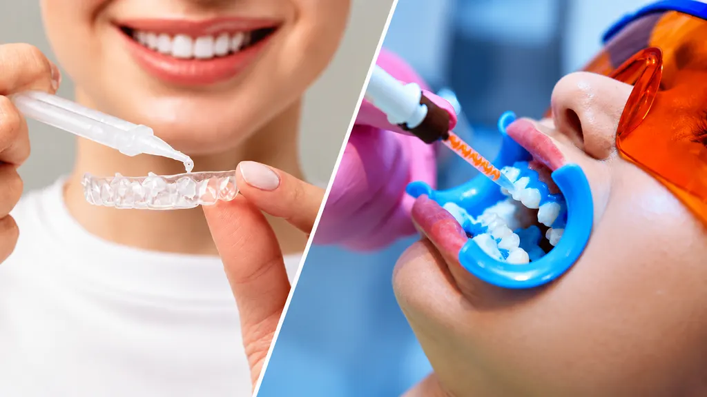 Comparação entre clareamento dental caseiro, em consultório e a laser