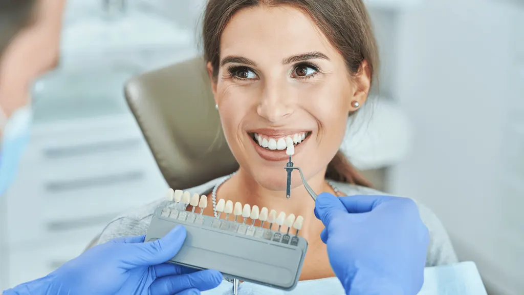 Sorriso com dentes clareados, ilustrando o guia completo sobre clareamento dental