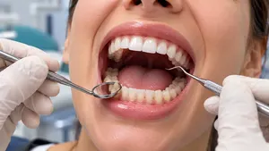 Dentista examinando os dentes de uma paciente com espelho clínico e sonda