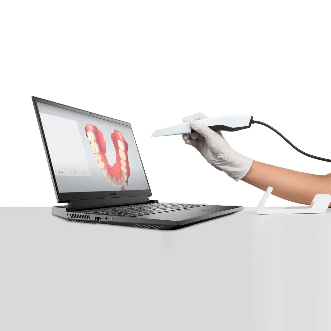 Escaneamento intraoral 3D com scanner Gnatus Panda P2 exibindo a imagem digital da arcada dentária em um notebook