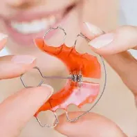 Expansor Palatino