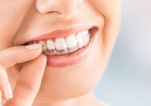 dentes tortos nunca mais