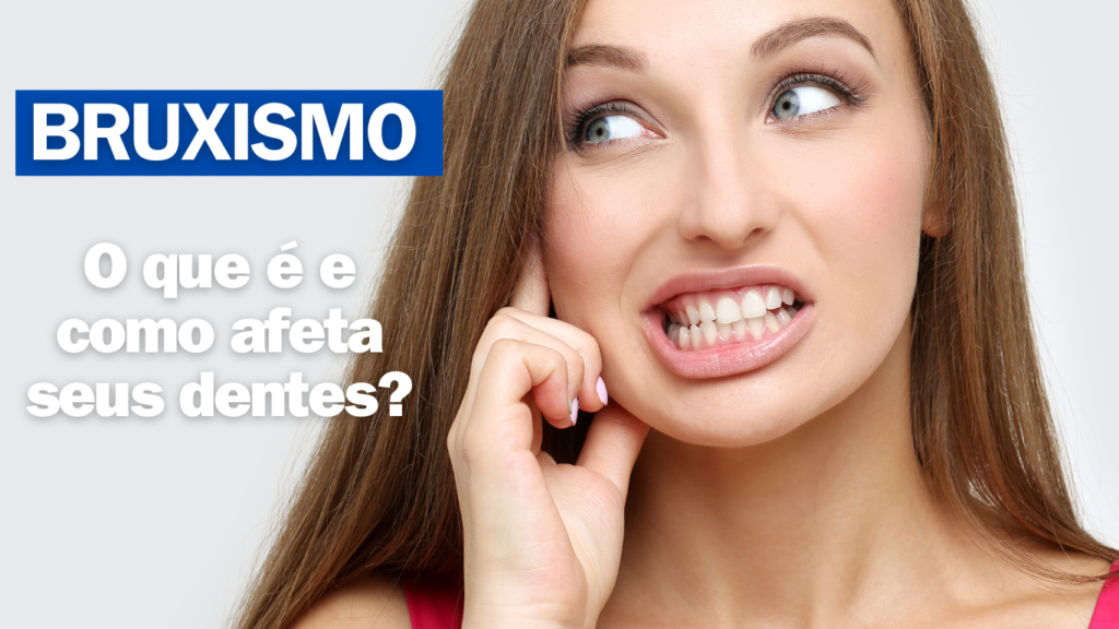 Ilustração representando o bruxismo do sono, o hábito de ranger os dentes durante a noite
