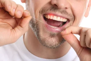 periodontite o que e causas sintomas e tratamentos
