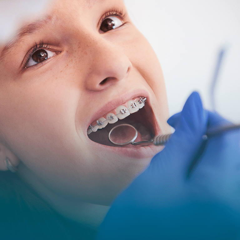 Dentista na Taquara - Tratamento ortodôntico na Stelle Odontologia.