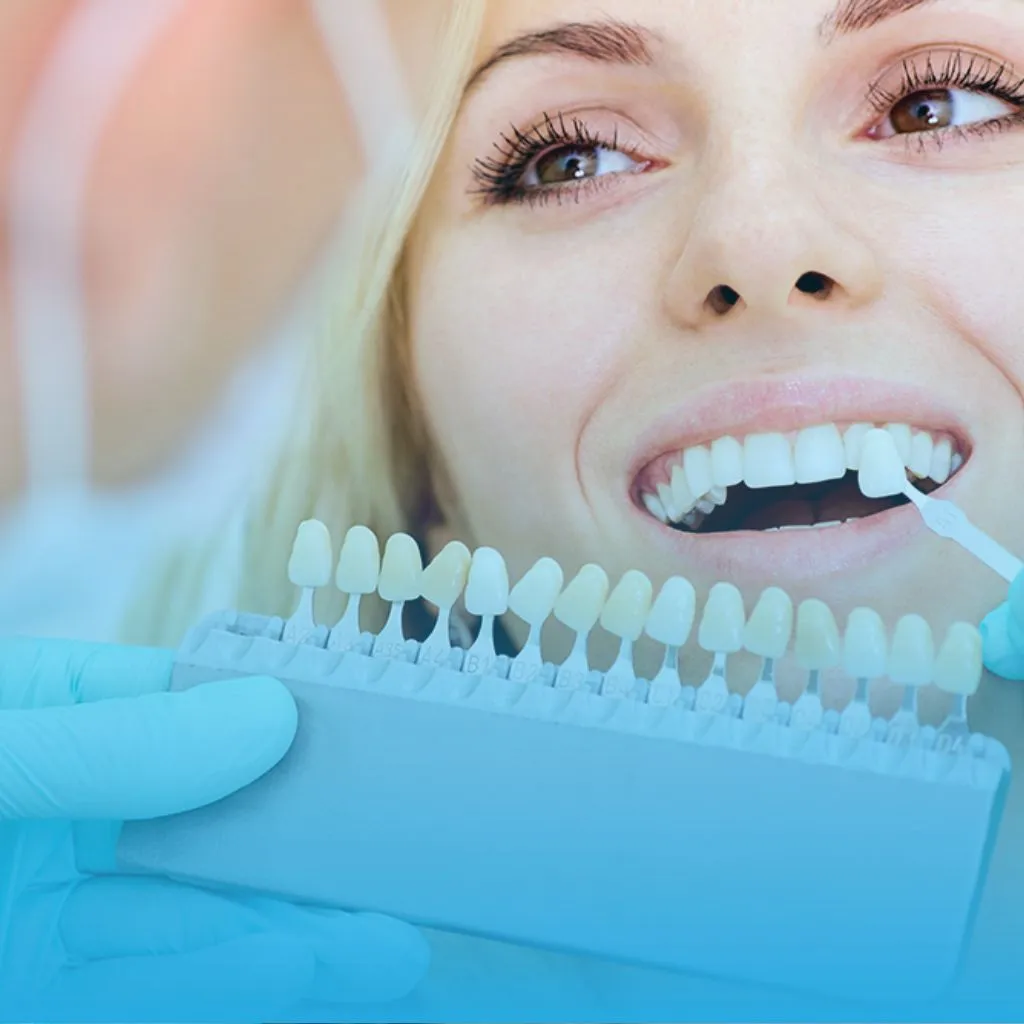 Dentista na Taquara - Clareamento Dental para um sorriso mais branco na Stelle Odontologia.