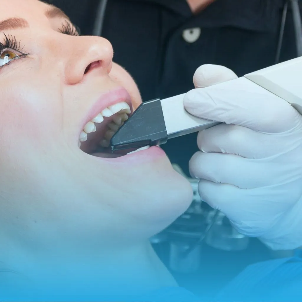 Dentista na Taquara - Escaneamento Intraoral para diagnósticos precisos na Stelle Odontologia.