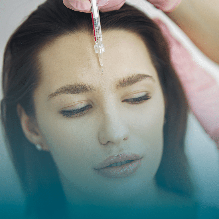 Dentista na Taquara - Aplicação de Toxina Botulínica (Botox) na Stelle Odontologia.